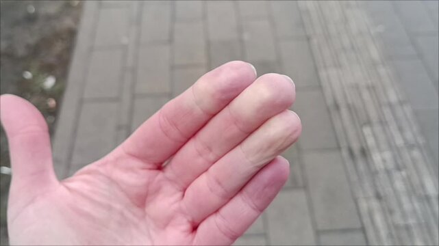 Raynaud syndrome diagnosis medical concepts, cold numb fingers on hand with color changes, vascular spasm, outdoor context, healthcare support.