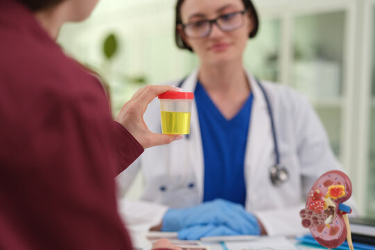 Woman patient holds urine sample cup near kidney model during clinic visit. Serious woman doctor studies container across desk preparing lab testing