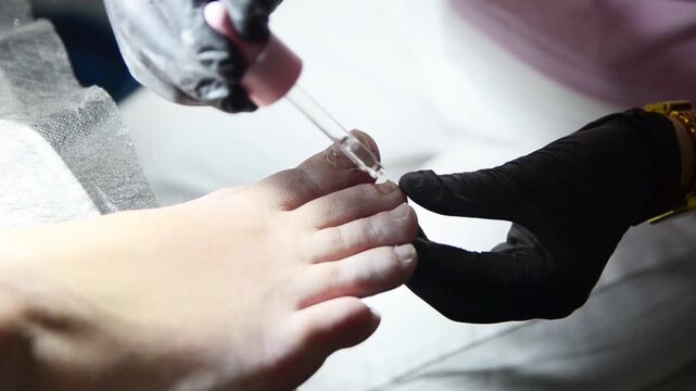 Pedicurist applies liquid cuticle care solution around a woman's toenail using a glass dropper. Close-up professional foot and nail care procedure.