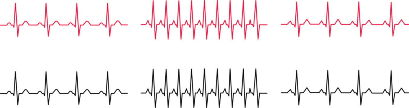 Set of electrocardiogram ecg heart rate monitor lines, normal sinus rhythm and tachycardia, medical diagnostic vector illustration