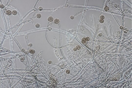 Microscopic mold spores suspended along filamentous hyphae slide