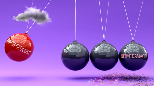 High Glucose leads to nerve damage. A Newton cradle metaphor showing how high glucose triggers nerve damage. Cause and effect relation between them. Vicious cycle ,3d illustration