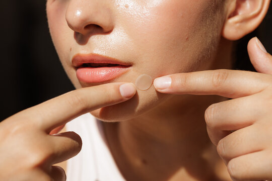 Close-Up of Woman Applying Acne Patch on Skin