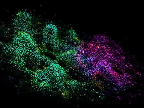 Conceptual fluorescence visualization of antibiotic stressed biofilm