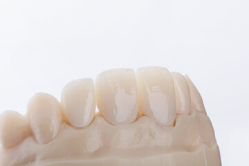 High-quality four dental crowns made of zirconium for fixation to the frontal teeth of upper jaw. © gorynvd