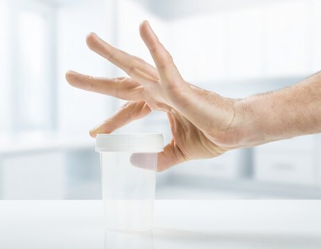 Close-up of a hand with a large clear specimen cup with a white screw cap on a white counter