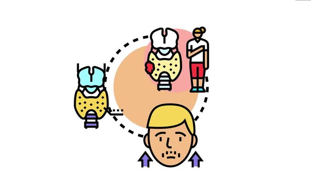 Thyroid gland dysfunction hormone imbalance, symptoms like goiter and fatigue, and the need for medical attention and endocrine care