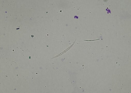 soil microorganisms under a microscope including amoeba, flagellates, nematodes, fungi, bacteria	