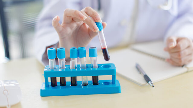 Close up hand of woman doctor holding test tubes red liquid of blood sample analysis medical vaccine innovation healthcare  scientist research technician development in laboratory hospital clinic.