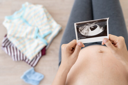 pregnant woman is looking at an ultrasound photo of fetus. Mother gently touches the baby on stomach. Happy, family, growth, pregnancy, enjoyment , prepare newborn, take care, healthcare, tummy.