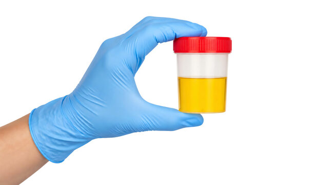 Hand wearing blue glove holding urine sample container isolated on transparent background