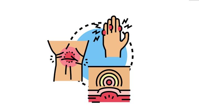 Arthritis joint pain problem showing inflammation and discomfort in human body joints, symptoms like swelling and chronic pain