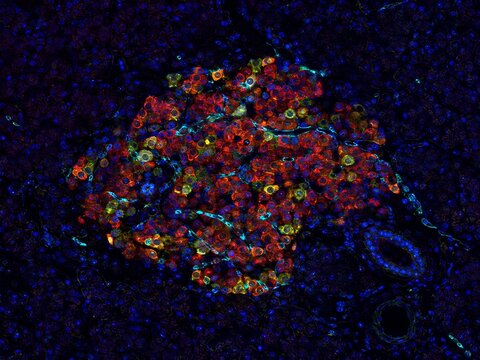 Human pancreatic islet with insulin and glucagon fluorescence visualization