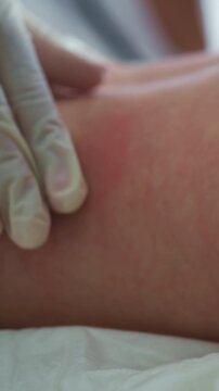 Close-up view of a baby's skin showing red patches and irritation, possibly indicating a rash or dermatitis Close-up footage highlights red patches and visible irritation.