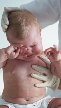 A doctor examines a crying baby's skin for signs of a rash, redness, and inflammation The doctor examines visible redness and inflammation while the baby cries.