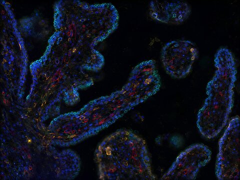 Human placental chorionic villi, multiplex fluorescence visualization