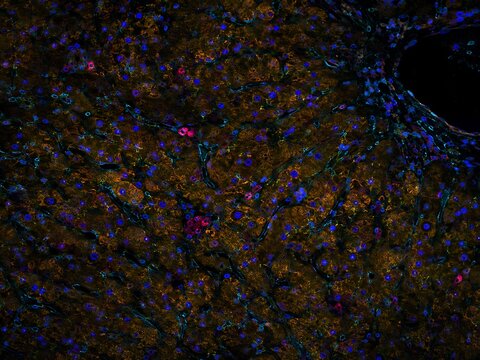 Human liver hepatocytes and sinusoids, fluorescence visualization