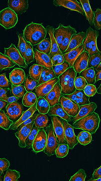 Fluorescent microscopy of cancer cells showing cellular structure and nuclei on black background