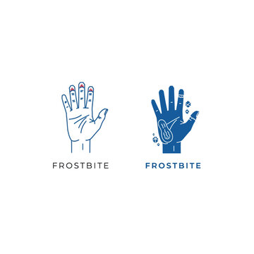 Frostbite hands logo design with cold weather and winter theme illustration