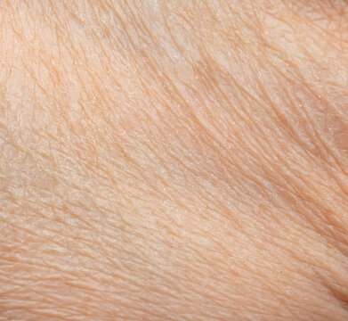 Macro texture of dry human skin, flaky epidermis closeup view, wrinkled body skin rough detail