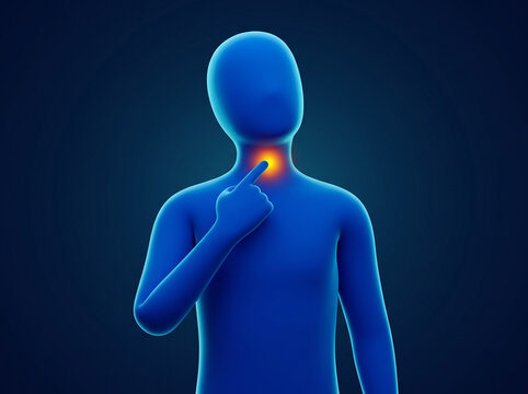 3D illustration of a person with a sore throat