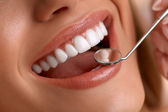 Bright smile during dental check-up at clinic