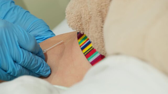 Physician methodically positions catheter in arm of patient lying quietly in comfortable position. Doctor gently installs catheter. Slow motion