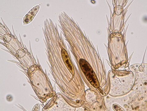 Microscopic view shows segmented insect legs with attached protozoa and other microorganisms. Tiny organisms swim in liquid, revealing cellular structures and details.