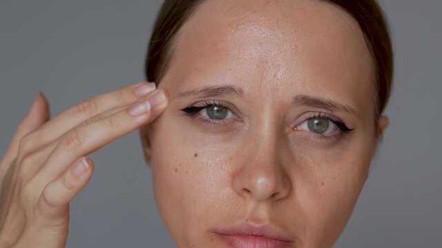Closeup of young woman showing oily forehead and shiny facial skin, demonstrating greasy texture, visible pores and excess sebum on face on gray background