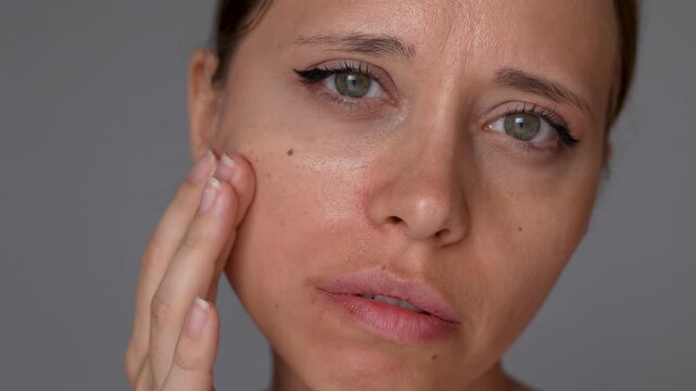 Young woman touching shiny cheek and nose area, demonstrating oily facial skin, excess sebum and greasy texture in closeup beauty portrait on gray background
