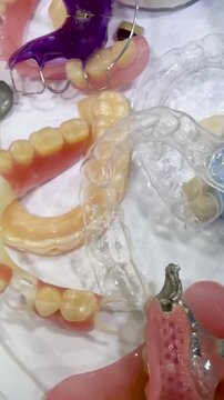 Dental laboratory workbench with denture models, wax bite blocks, and prosthetic teeth samples in various stages of production