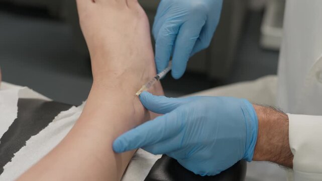 Gloved hands guiding a fine syringe into a vein on the foot of a patient in a clinic