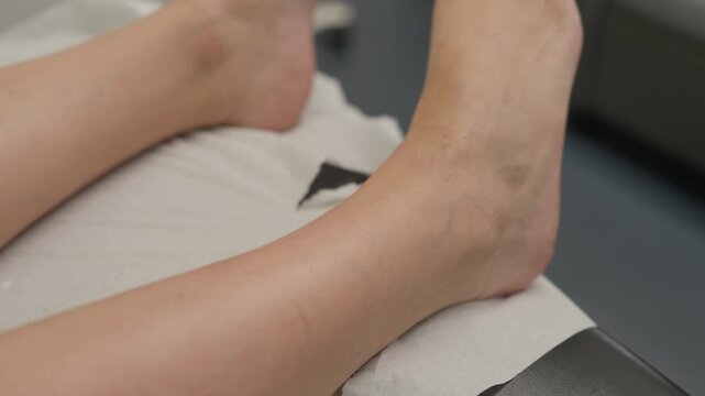 Bare ankles and feet of a patient with visible veins resting on a clinic exam table