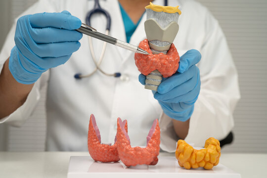Hyperthyroidism, Overactive Thyroid, Thyroid Lymphoma, Asian doctor with thyroid gland human anatomy model in hospital.