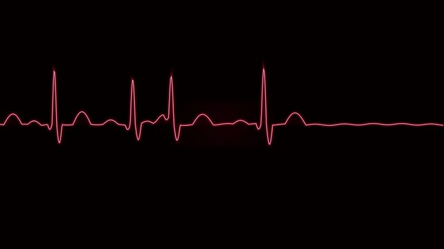 Red ekg heartbeat monitor line loop, medical pulse waveform animation for healthcare and cardiology projects