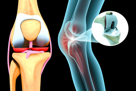 Human knee anatomy joint structure with bones, ligaments, and tendons on a black isolated background.