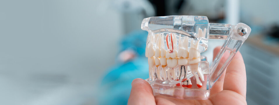 Model of human jaw teeth in a dental office with a blurred patient in the chair in the background banner copy space