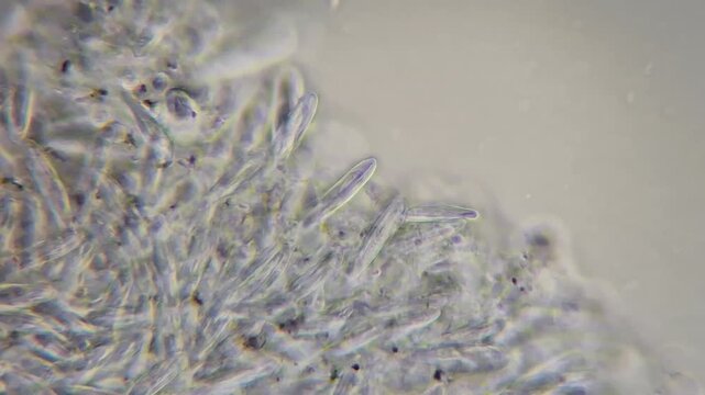 Microscopic view of jellyfish tentacle under microscope showing dense cnidocytes 