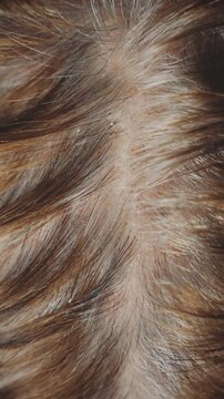 human head close-up grown gray hair roots brunette dyed color. person aging gray hair top view, hands fingers scratch touch skin, fungus dandruff irritation, health hair treatment. medicine trichology
