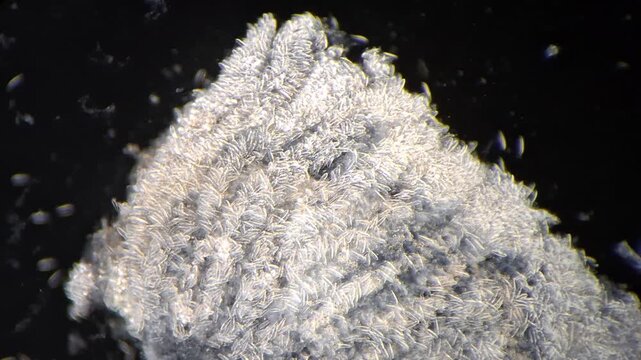Microscopic view of jellyfish tentacle under microscope showing dense cnidocytes in darkfield