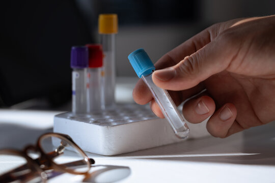 Doctor Hand Holding Blood Test Tube Laboratory