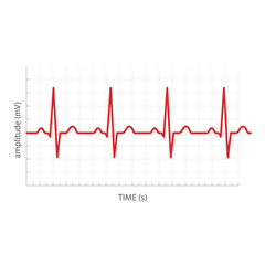Fototapeta premium Red electrocardiogram heart rate rhythm graph on a white grid background