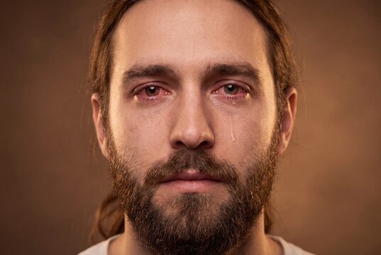 Sad crying man with red watery eyes and tears emotional portrait close up