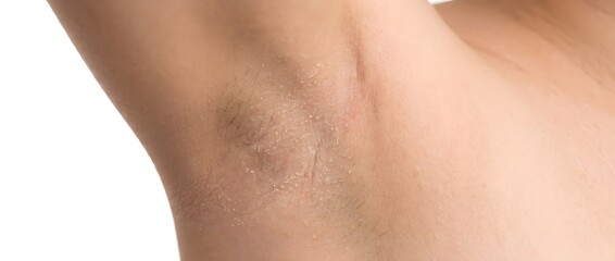 Naklejka premium Close up of human armpit with visible hair and smooth skin texture
