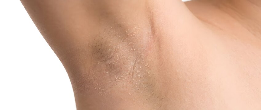 Close up of human armpit with visible hair and smooth skin texture