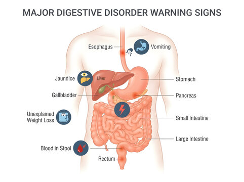 Major digestive disorder warning signs diagram isolated on white background
