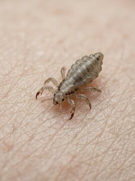 Macro photograph of a louse crawling on human skin. Detailed close-up showing insect anatomy, claws, and skin texture