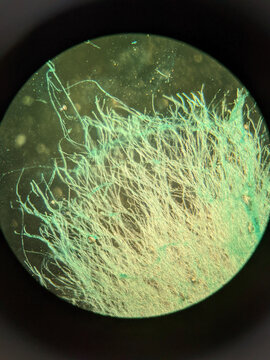 Aspergillus fungal colony section showing conidiophores growing on agar sur