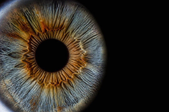 Radiating Iris Fibers Around the Dark Pupil