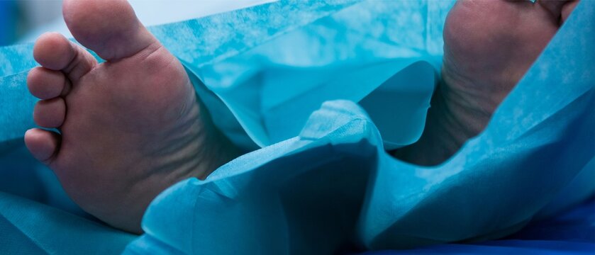 Patient's feet covered with blue surgical drape before operation in hospital, close-up